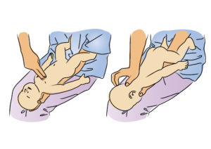 Phương pháp vỗ lưng ấn ngực