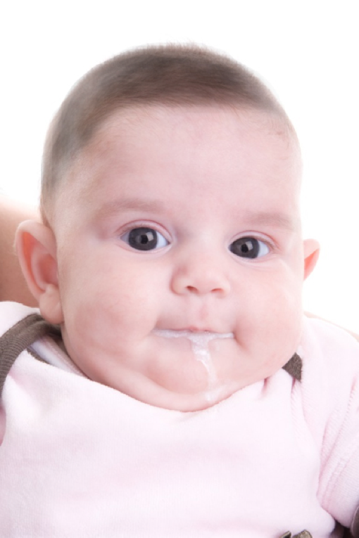 80% các bé sơ sinh khoẻ mạnh bị nôn trớ trào ngược